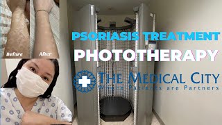 Psoriasis Treatment  Phototherapy in Medical City  Healing Journey  Plus Salon Day [upl. by Loreen]