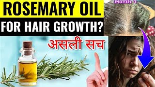 Viral Hair Growth Secret Rosemary Oil for Faster Hair Growth  Hair Loss Treatment  Hair oil [upl. by Nireves]