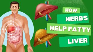 Herbs for Fatty Liver Natural Solutions to Boost Liver Health [upl. by Elleivap]