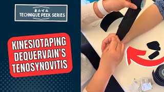 Kinesiotaping Technique for Treatment of DeQuervains Tenosynovitis  Technique Peek Series [upl. by Yhtir660]