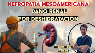 Nefropatía Mesoamericana Deshidratación Crónica y Daño Renal  Dr Gilberto Alcalá [upl. by Nrublim313]