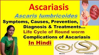 Ascariasis  Ascaris Lumbricoides  Symptoms Causes Diagnosis Treatment  Roundworm life cycle [upl. by Rani]