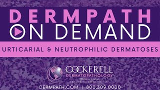 Urticarial and Neutrophilic Dermatoses [upl. by Ahsined]