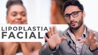 LIPOPLASTIA FACIAL  Dr Thales Cousen [upl. by Heidt]