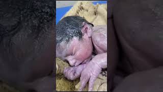 Vernix caseosaknown as vernix is the waxy white substance found coating the skin newborn human baby [upl. by Niwdla304]