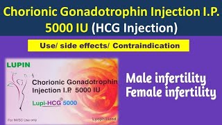 LupiHCG 5000 IU injection  Chorionic Gonadotrophin Injection IP 5000 IU Use [upl. by Atiuqiram468]