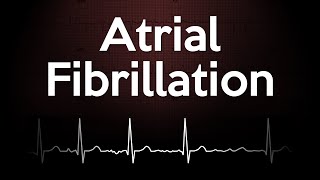 Atrial Fibrillation ECG Explained [upl. by Anaik]