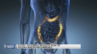 Study Celebrex reduces risk of colon cancer recurrence — and more [upl. by Elacim]