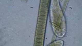 Ciliate Protozoa Wander Around the Salt Pond [upl. by Aveline]