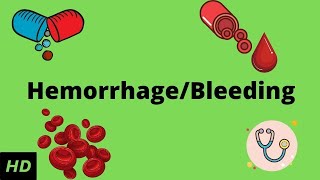 Hemorrhage bleeding Causes Signs and Symptoms Diagnosis and Treatment [upl. by Artemla954]