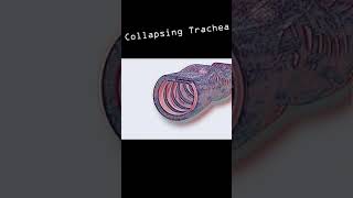 Collapsing Trachea in dogs shorts [upl. by Nwahsad]