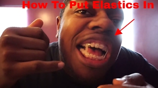 HOW TO Put ElasticsBands In For Braces Feat My Secret Twin [upl. by Pope]