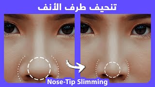 How to naturally slim the nose tip  Fix wide nose tip  Fix Bulbous nose tip [upl. by Anawad]