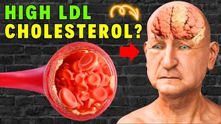 High LDL Cholesterol 10 Foods to Fight Back Naturally [upl. by Clements214]