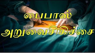 பைபாஸ் அறுவைசிகிச்சைதெரிந்து கொள்வோம் Bypass Surgery heartattack health [upl. by Anceline402]