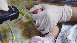 How to check RBS in newborn babyHeel prick for glucose test in babybabynicu newbornhospital [upl. by Carman725]