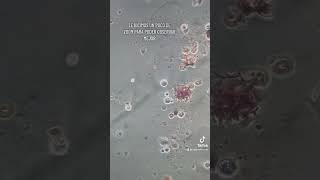 Leucocitos y eritrocitos en muestra de orina labclinico🦠🔬 ego leucocitos eritrocitos [upl. by Sorgalim546]