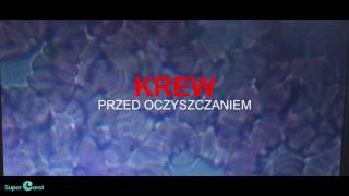 ⭐️TEST CORAL COLOVADA PLUS  KREW PRZED i PO OCZYSZCZANIU  SUPERCORALPL ⭐️ [upl. by Nbi]