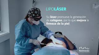 Conoce más de la LipoLaser [upl. by Toby833]