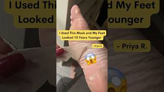 How to Use Foot Peel Mask for Insane Results  Baby Soft Feet Without Pain shorts feet peeling [upl. by Nileuqaj968]