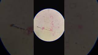 bacteria azotobacter under a microscope science biology [upl. by Gracie]