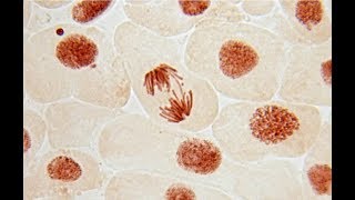 Chromosomal Aberration  Structural Aberration  Botany Tamil [upl. by Alford715]