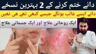 acne control treatment acne pimples remove face wash  dany khatam karne ka best tarika [upl. by Ssej]