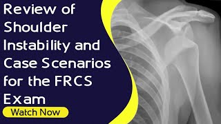 Review of Shoulder Instability and Case Scenarios for the FRCS Exam  Orthopaedic Academy [upl. by Snehpets397]