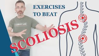 How To Beat Scoliosis Naturally In 4 Minutes A Day  WITHOUT Chiropractor Or Bone Cracking [upl. by Avrenim848]