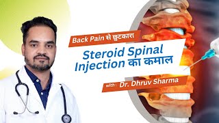 कमर दर्द से मुक्ति Epidural Steroid Spinal Injections for Lower Back Pain की संपूर्ण जानकारी [upl. by Shields]