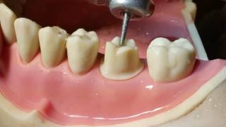 Molar Crown Preparation Walkthrough tutorial in the Simulation Lab [upl. by Kutzenco]