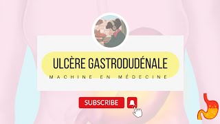 lUlcère Gastroduodénale UGD [upl. by Nosyla]