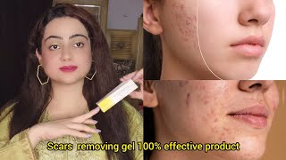 Acne scars removal Gel  contractubex Gel beauty facts acnescars scars pimples [upl. by Etnovert]