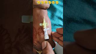 181 IV Cannulation Technique  Cannula Lagana Sikhe cannula shortfeed viralreel trend videos [upl. by Imim]