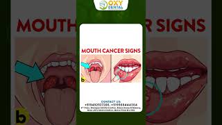 What is Mouth Cancer  Best Hospital In Hyderabad  Early Signs  Symptoms  Treatment  Oxy Dental [upl. by Elva85]