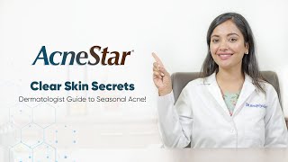 How to treat seasonal acne  AcneStar Gel  AcneKaSpecialist  Ft Dr Anupriya Goel [upl. by Doralin]