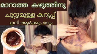 Remove darknesspigmentation around neckampunderarms in one use എന്ത് ചെയ്തിട്ടും മാറാത്തവർക് [upl. by Reggy]