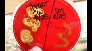 Blood Agar Bacterial Growth Medium Alpha Beta amp Gamma Hemolysis [upl. by Philis]