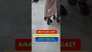 Antalgic gait video of patient  analysis example  description and pattern of Gait gait [upl. by Friedland]