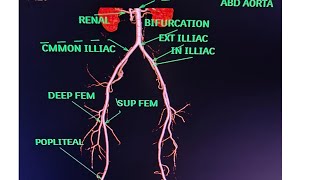 CT Lower Limb Angiography Anatomy CT scanPost processing avnishradiologypart1 [upl. by Veator]