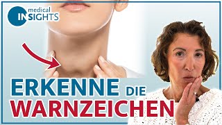 Schilddrüsenüberfunktion Dos and Donts  Behandlung Ernährung Therapie  medical INSIGHTS [upl. by Ailuig]