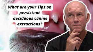 What are your Tips on persistent deciduous canine extractions [upl. by Gilder]