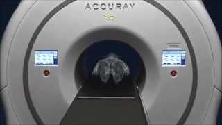 Accuray® TomoTherapy® H™ Series [upl. by Storz]