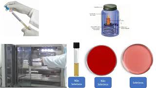 MicrobiologiaQuais meios de cultura iremos utilizar para semear uma secreção purulenta [upl. by Alaehs120]