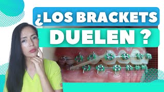 ¿LOS BRACKETS DUELEN  Consejos para solucionarlo [upl. by Dever]