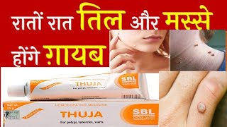 Thuja cream ke fayde in hindi  Thuja Homeopathic Medicine for moles  Thuja ointment  warts cream [upl. by Enobe]