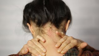 11 Pressure Points For Headache Relief [upl. by Laniger]