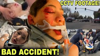 FOOTAGE of Nidal Wonder SCOOTER CRASH ACCIDENT 😱😳 TERRIBLE CAR ACCIDENT EXPLAINED [upl. by Lebbie]