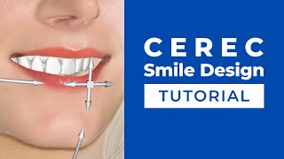 CEREC Smile Design Tutorial  How to Set Up and Use the Smile Design Function  CEREC Masterclass [upl. by Sakul158]