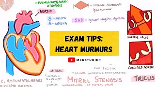 What is a heart murmur and what can cause it [upl. by Mulligan337]